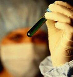 hogyan kell tesztelni a parazitákat