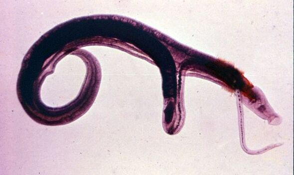 A schistoszómák az egyik leggyakoribb és legveszélyesebb parazita